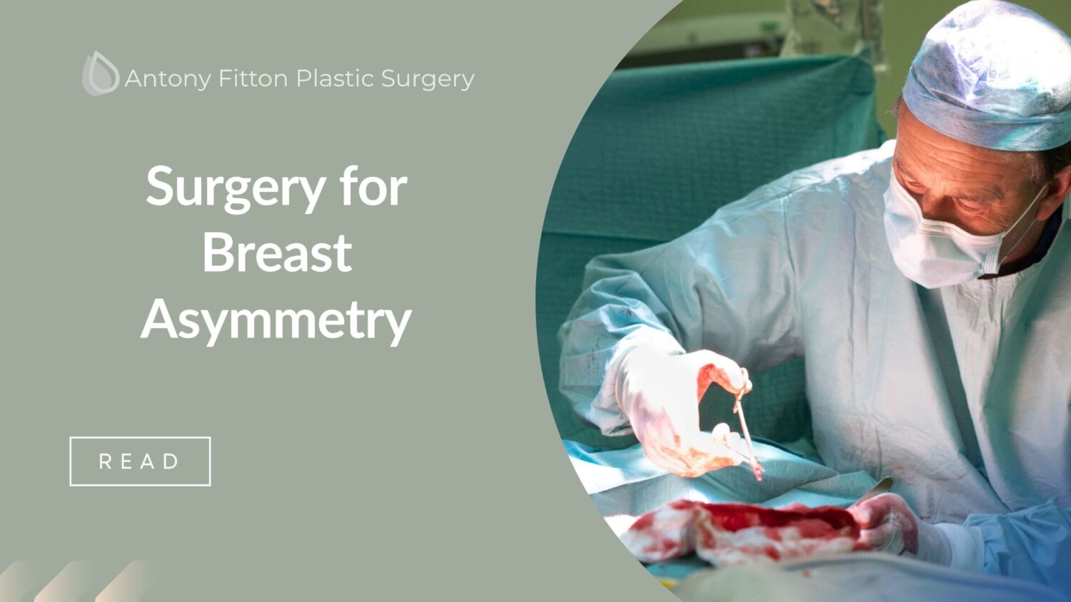 Surgery for Breast Asymmetry