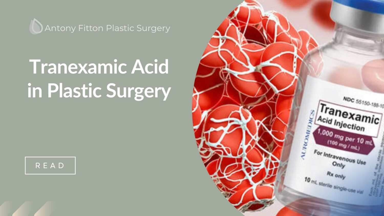 Tranexamic Acid in Plastic Surgery