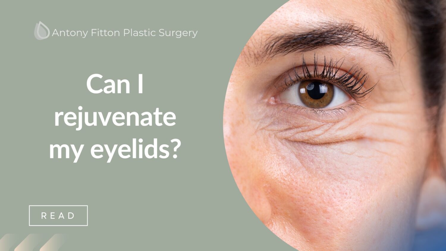 Can I rejuvenate my eyelids?