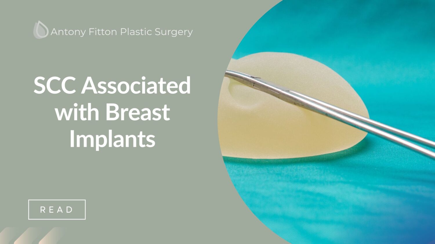 SCC Associated with Breast Implants