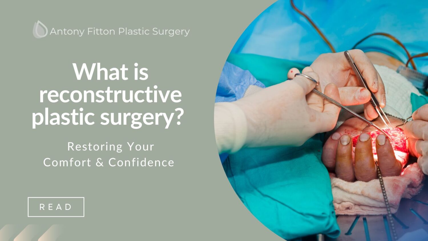 Plastic Surgery for Reconstruction What is reconstructive plastic surgery?