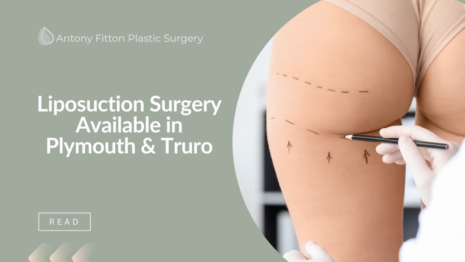 Liposuction Surgery Available in Plymouth & Truro