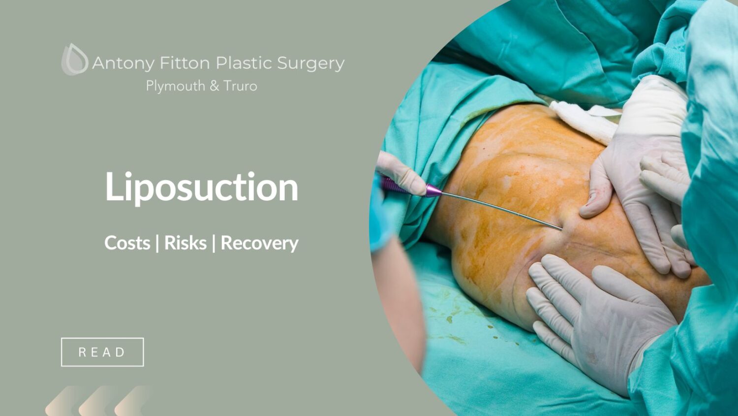 Liposuction Costs | Risks | Recovery Antony Fitton Plastic Surgery Plymouth & Truro