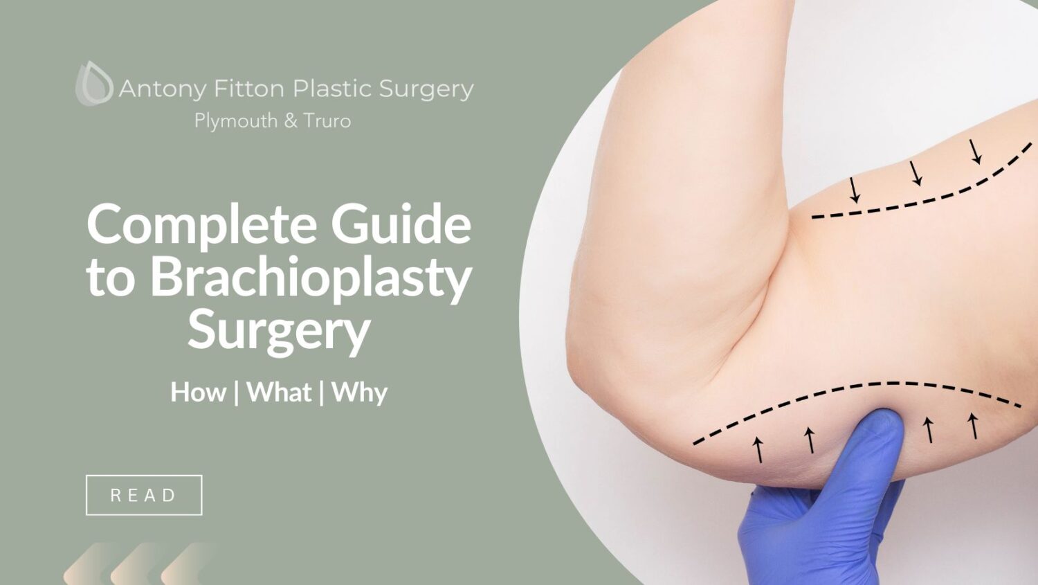 Complete Guide to Blepharoplasty | Antony Fitton Plastic Surgery | Plymouth and Truro