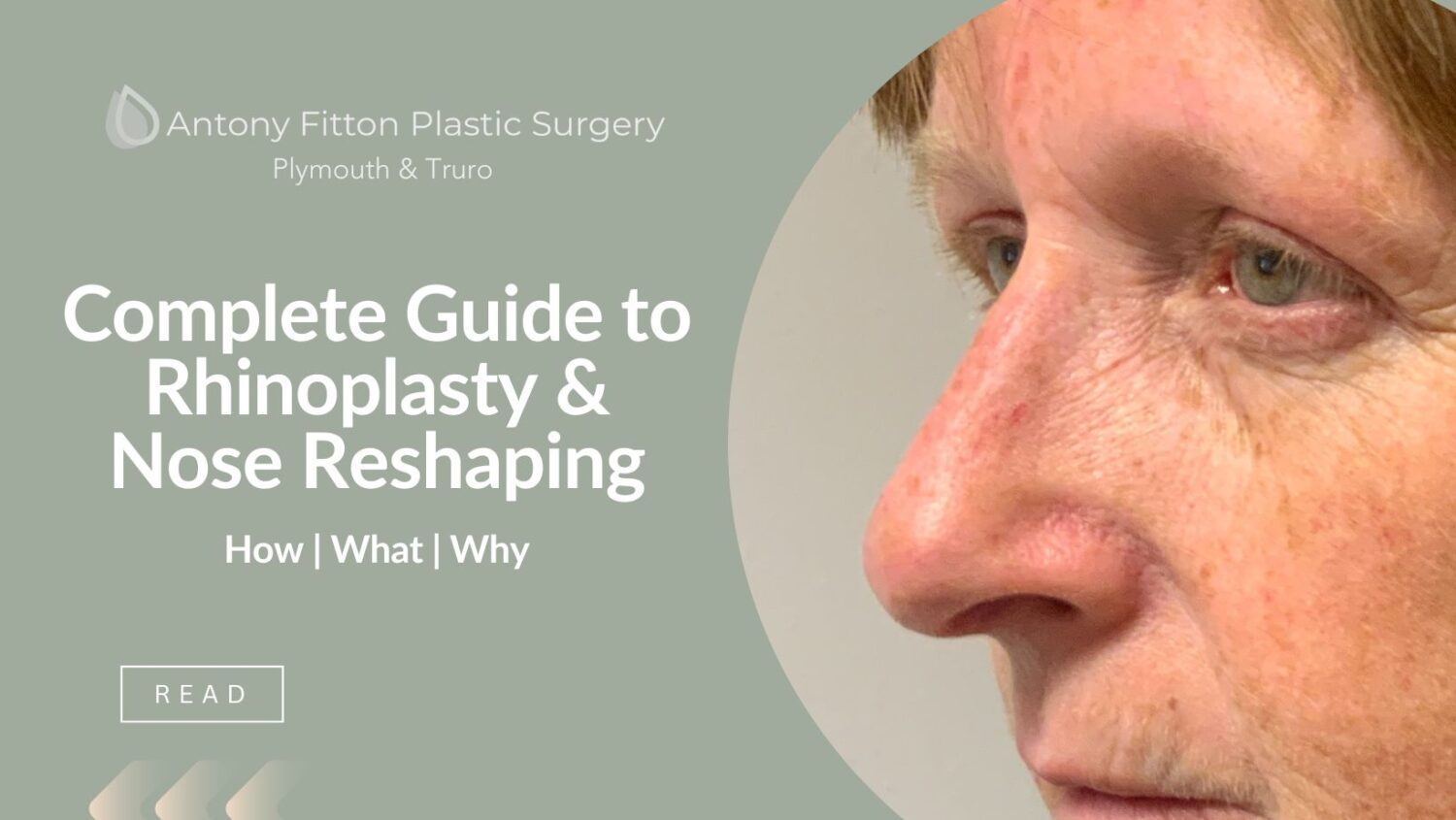 Guide to Rhinoplasty & Nose Reshaping | Antony Fitton Plastic Surgery | Plymouth and Truro