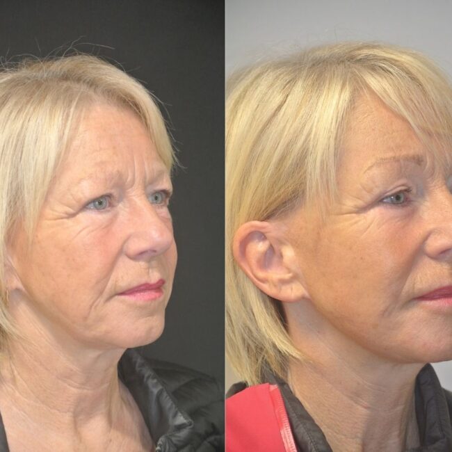 The 5 main areas to consider when undergoing Facial Surgery - Get reconstructive or aesthetic Facial Surgery in Plymouth.The 5 main areas to consider when undergoing Facial Surgery - Get reconstructive or aesthetic Facial Surgery in Plymouth.