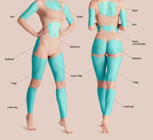 How to create the look you desire with Liposuction | Antony Fitton Plastic Surgery | Plymouth and Truro