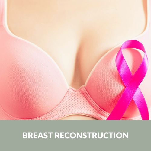 Mastectomy, or surgical removal of the breast, is a common therapeutic and prophylactic treatment for breast cancer | Antony Fitton Plastic Surgery | Plymouth and Truro
