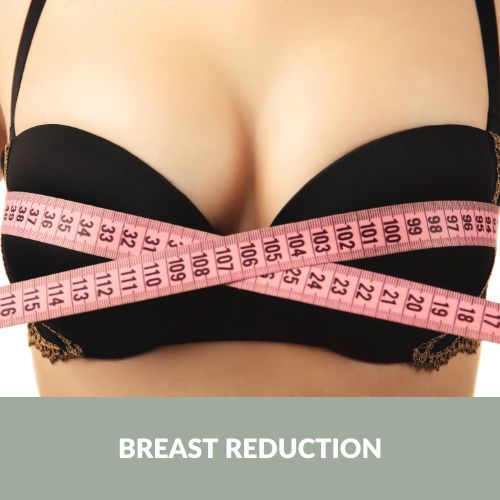 Breast reduction is a surgical procedure to alter the shape and size of the breasts | Antony Fitton Plastic Surgery | Plymouth and Truro