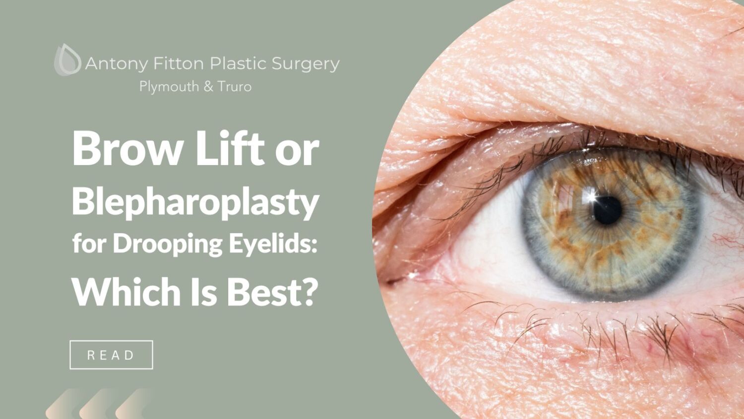 Brow Lift or Blepharoplasty for Drooping Eyelids: Which Is Best?