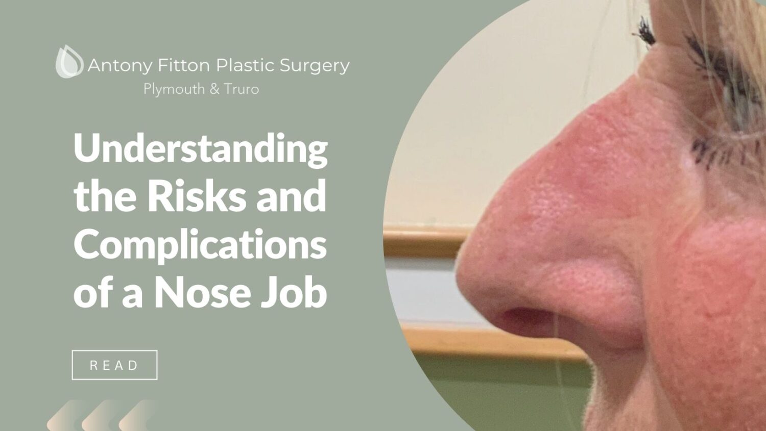 Understanding the Risks and Complications of a Nose Job Procedure