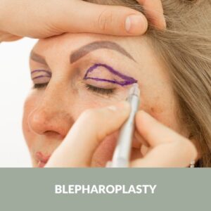 Blepharoplasty