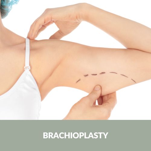 Brachioplasty