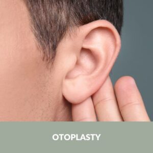 Otoplasty