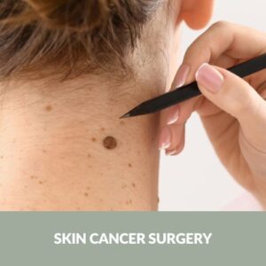 Skin Cancer Surgery