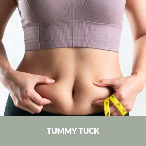 Tummy Tuck