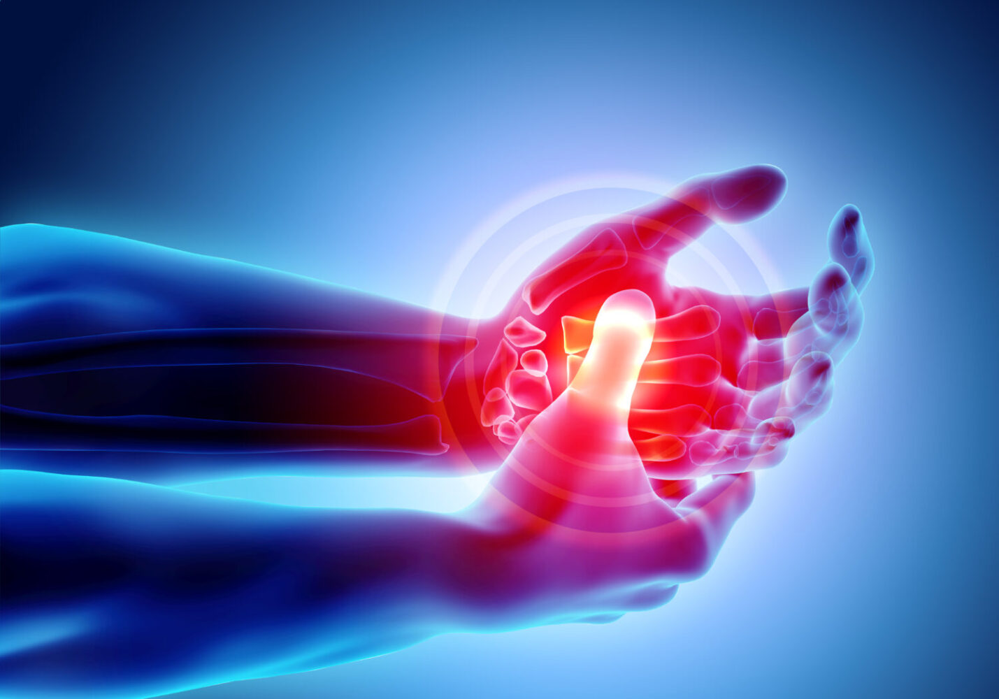 Hand Disorders: Why Early Intervention is Recommended for Pain Relief and Joint Preservation