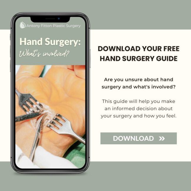 Hand Surgery Guide | Antony Fitton Plastic Surgery | Plymouth and Truro.