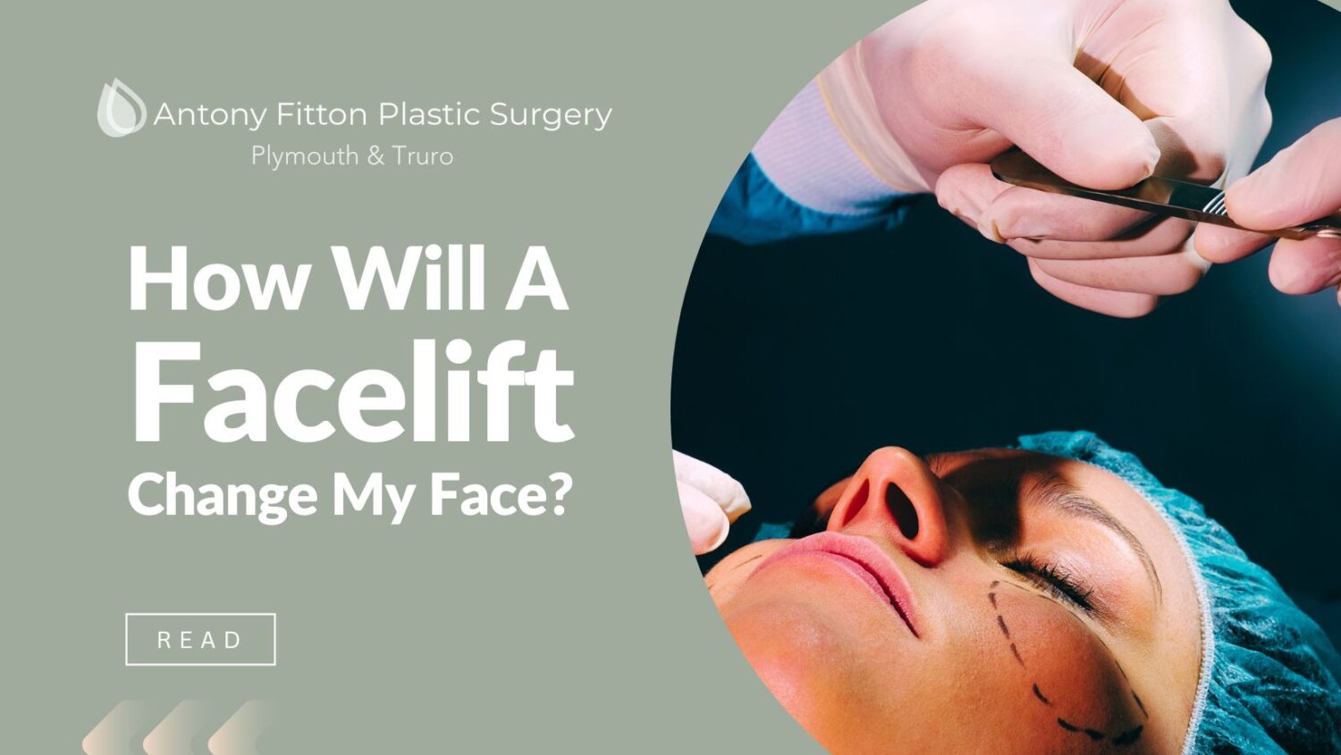 How Will a Facelift Change My Face?