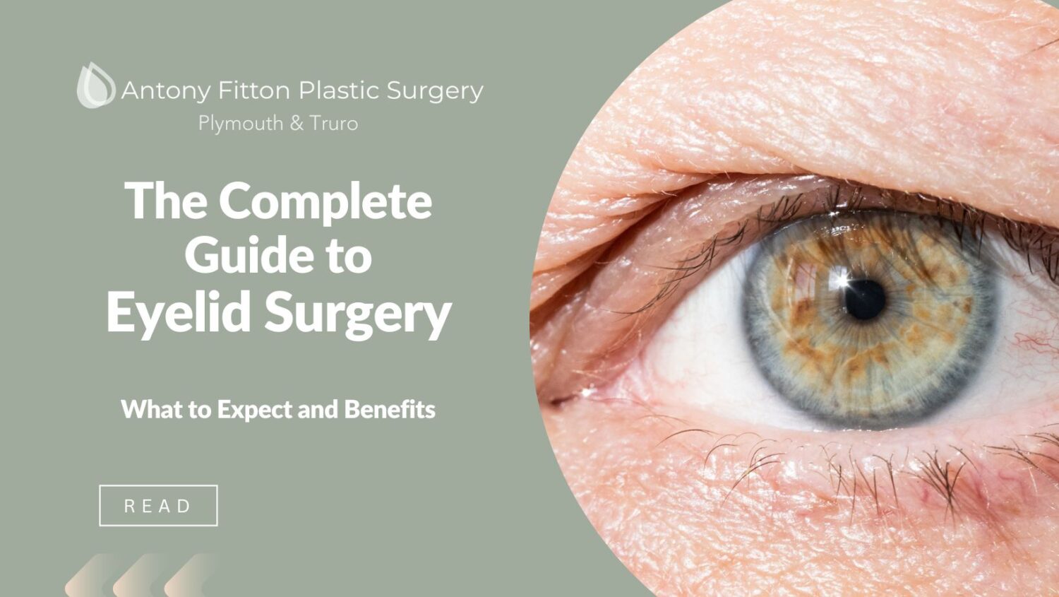 The Complete Guide to Eyelid Surgery: What to Expect and Benefits