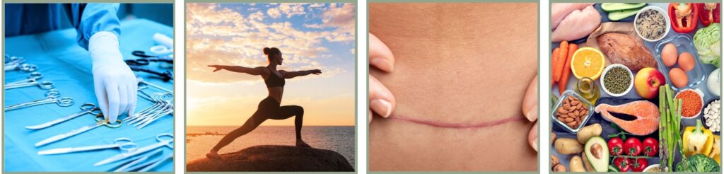 Factors Influencing Plastic Surgery Recovery Duration