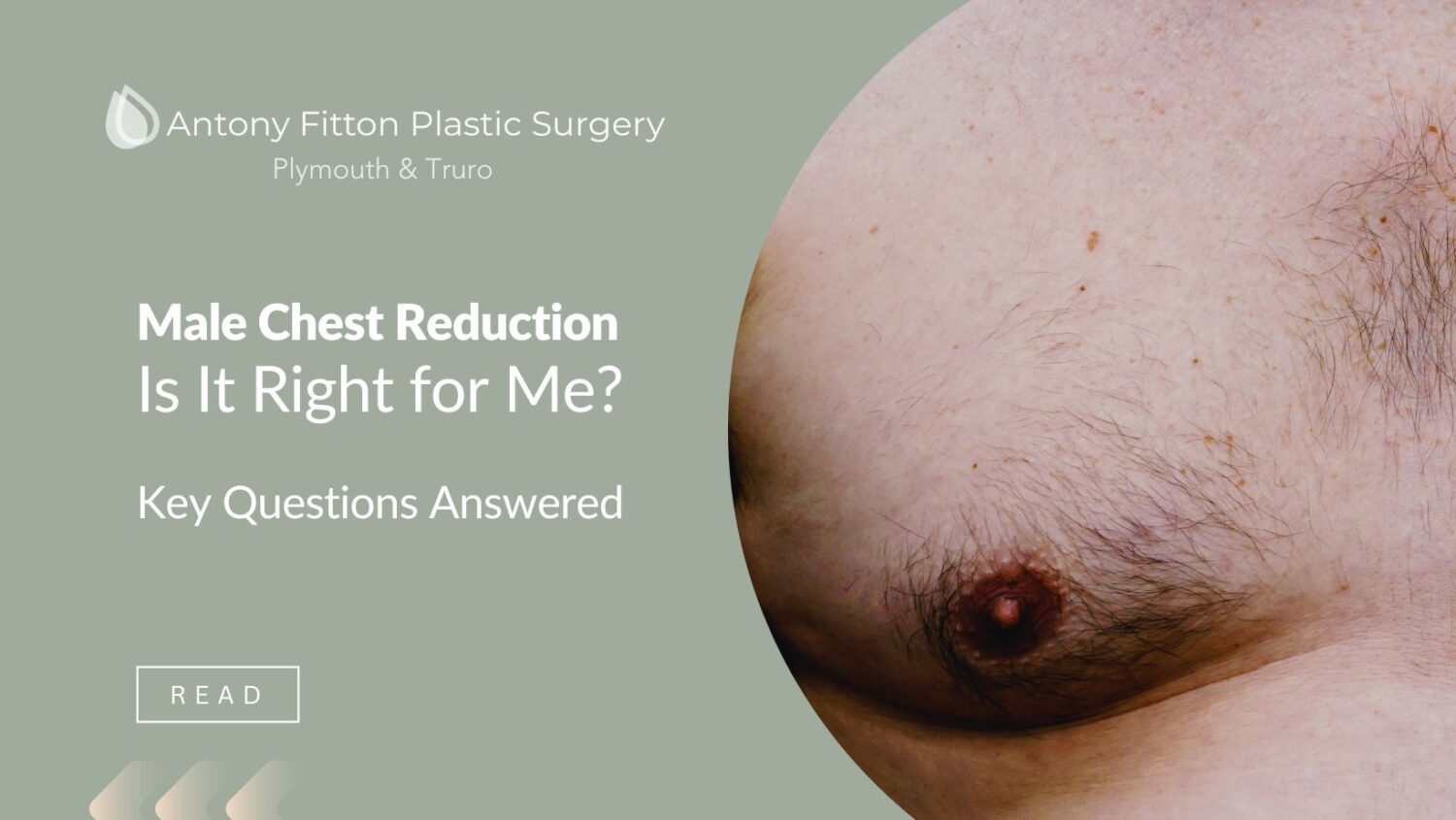 Is Male Chest Reduction Right for Me? Key Questions Answered | Antony Fitton Plastic Surgery | Plymouth & Truro