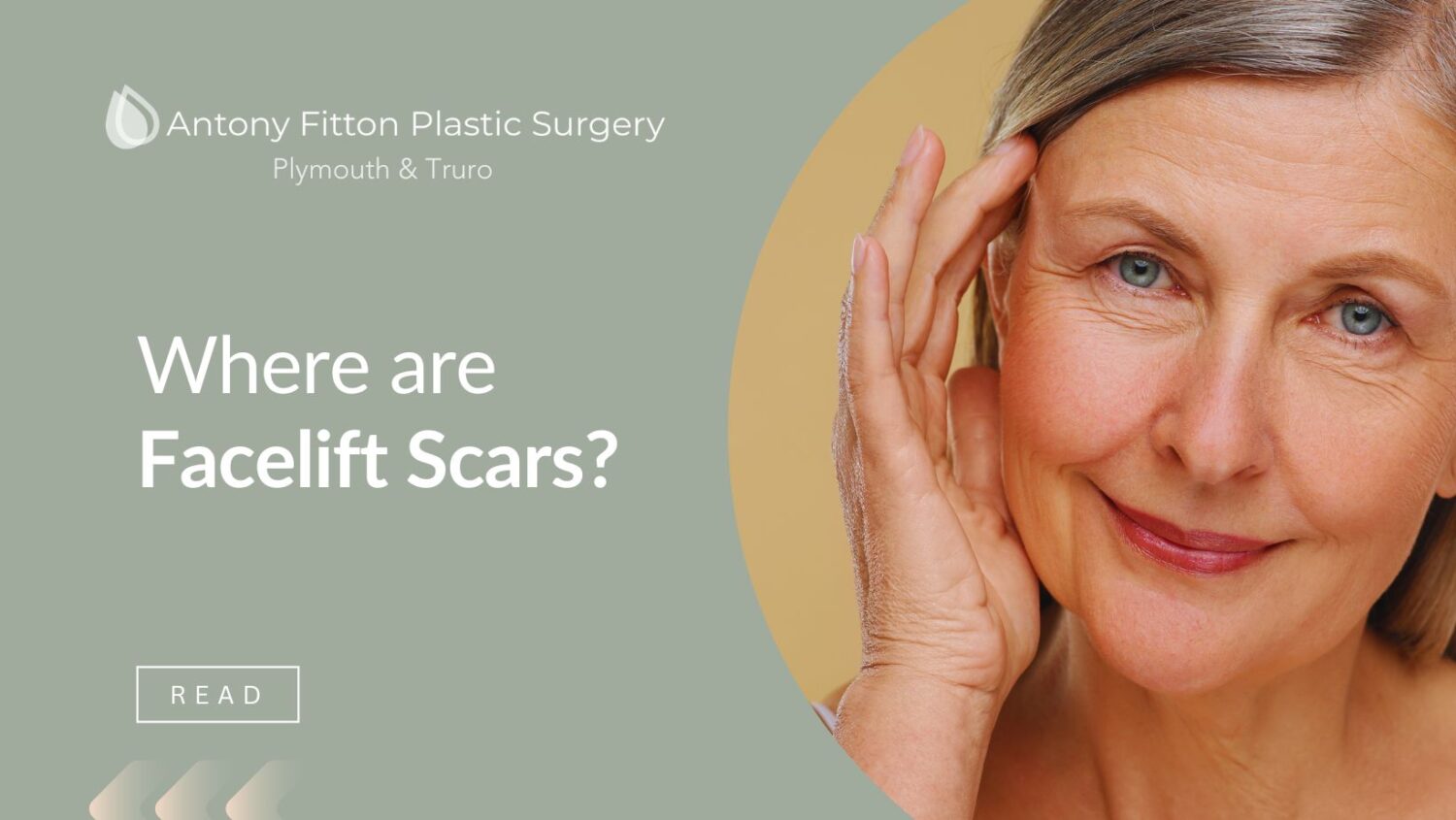 Where are Facelift Scars? | Antony Fitton Plastic Surgery | Plymouth & Truro