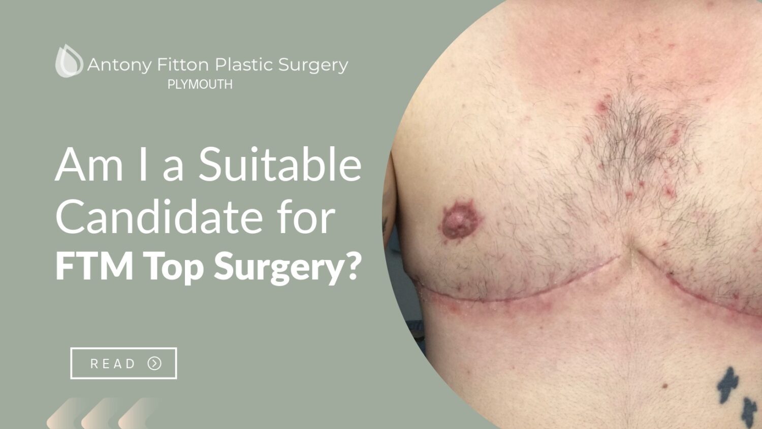 Am I a Suitable Candidate for FTM Top Surgery? | Antony Fitton Plastic Surgery | Plymouth