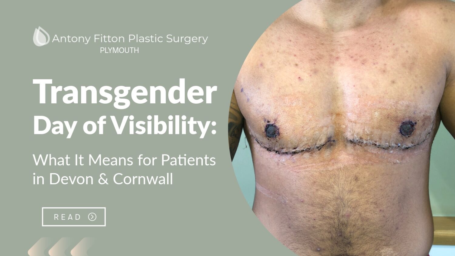 Transgender Day of Visibility highlights support, visibility, and access to gender-affirming care. Learn about your FTM top surgery options | Antony Fitton Plastic Surgery | Plymouth